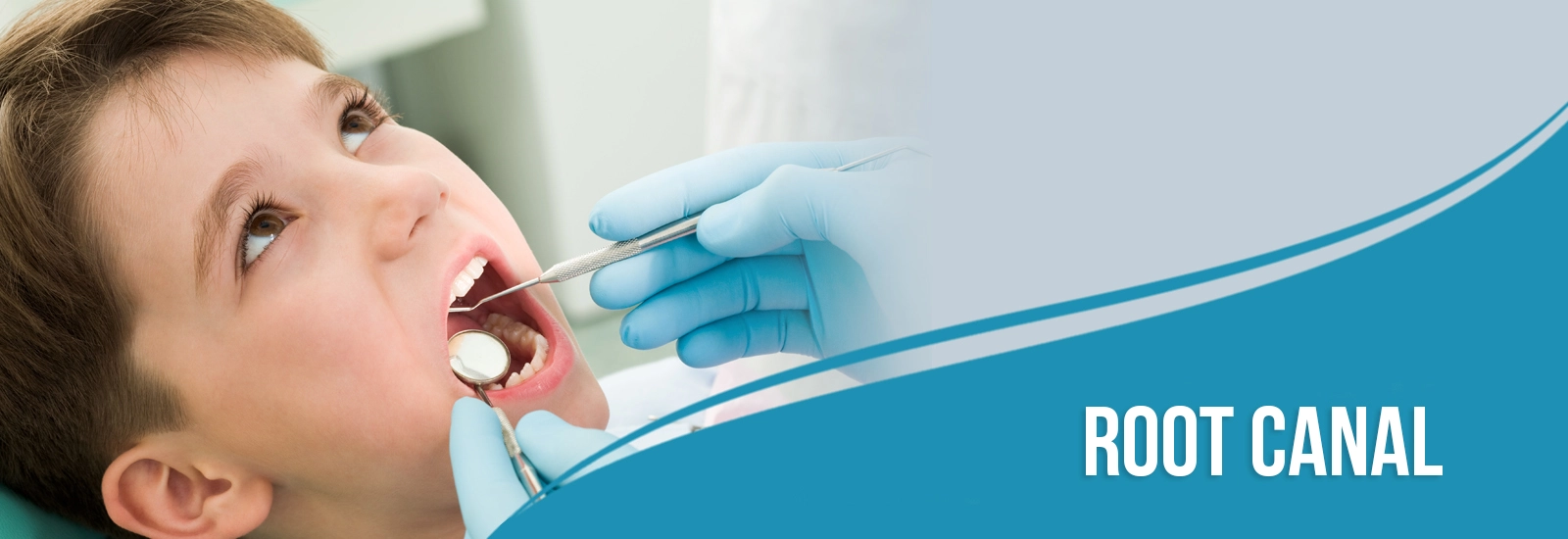 top dental implants in Dwarka Like A Pro With The Help Of These 5 Tips