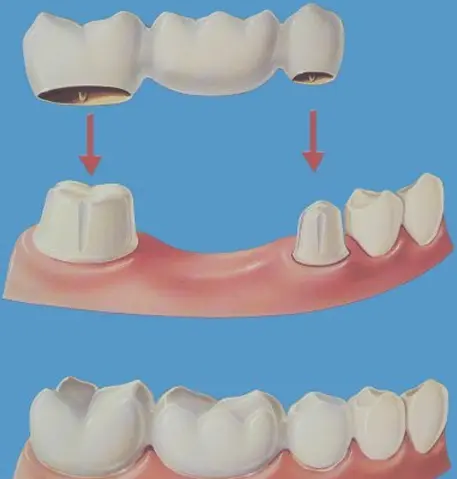 dental-home-treatment